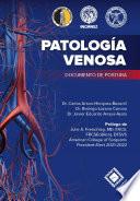Libro Patología Venosa